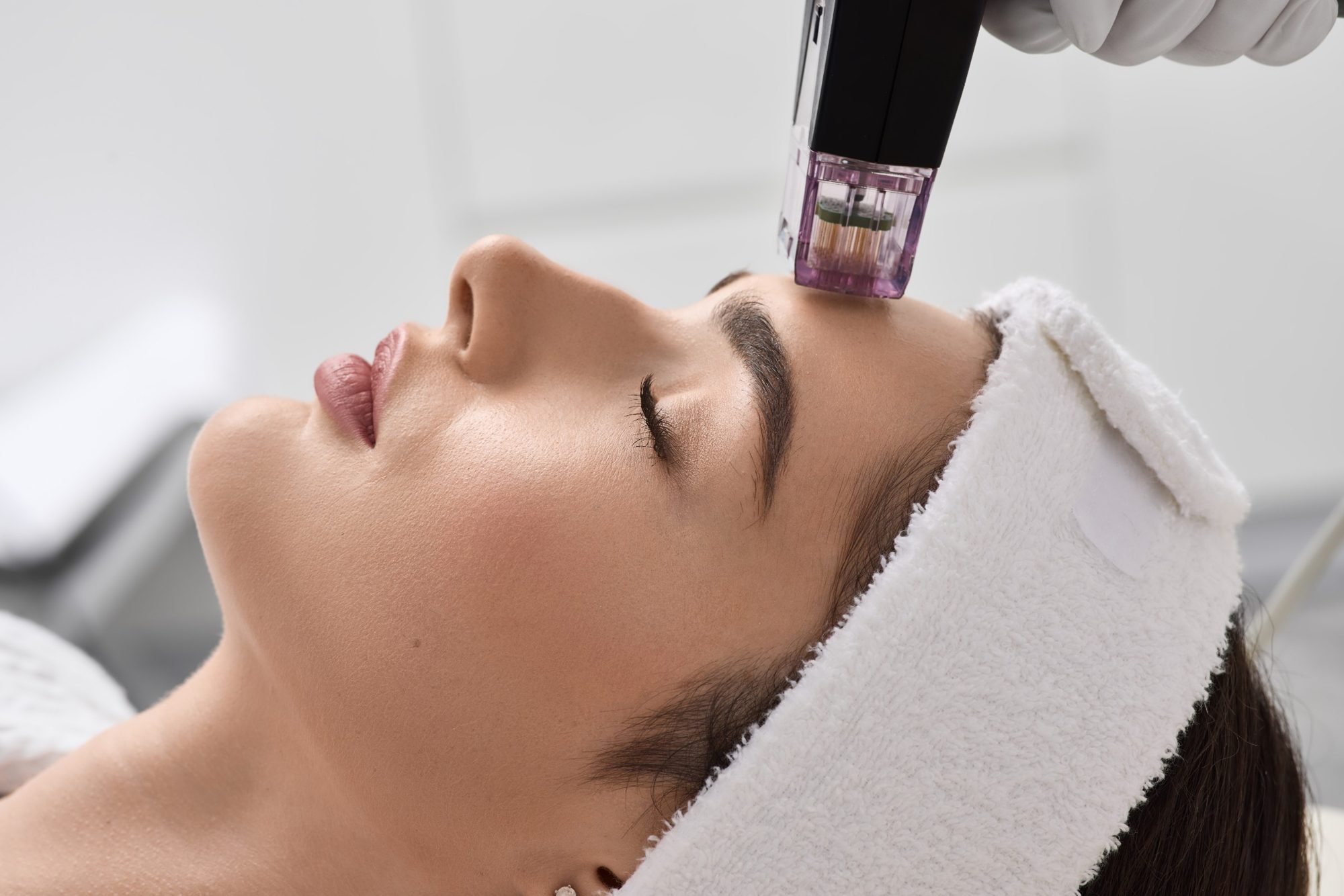 Non-Surgical Facelift with Neogen Plasma