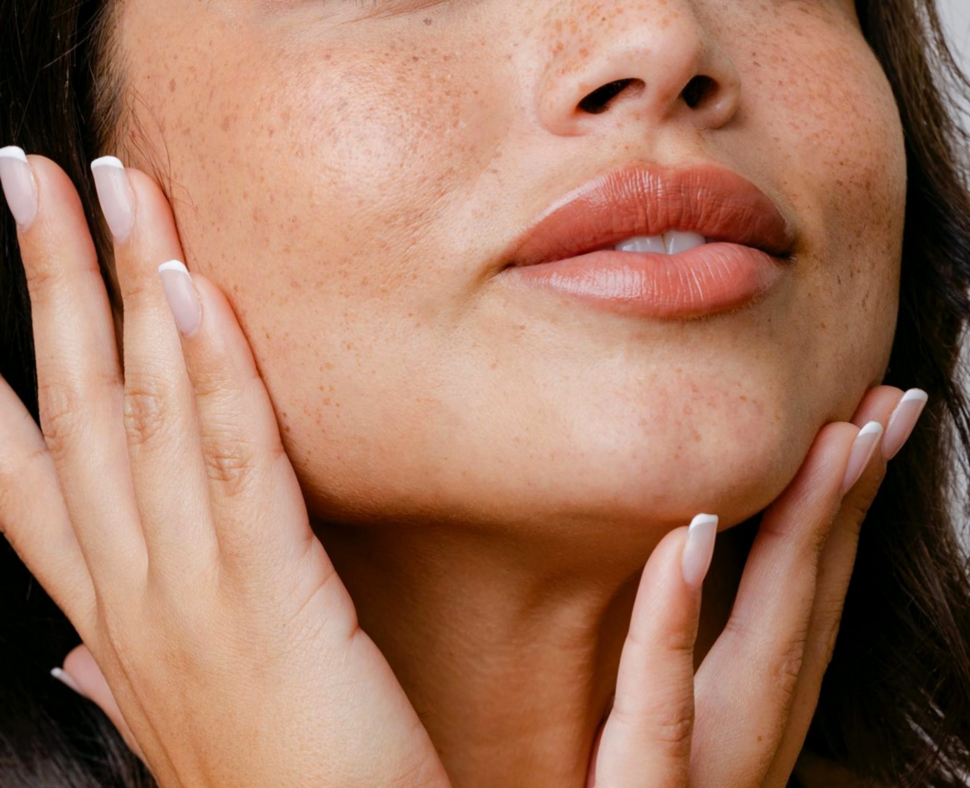 Close-up of a woman's smooth, even-toned skin after plasma skin regeneration in Katonah, NY