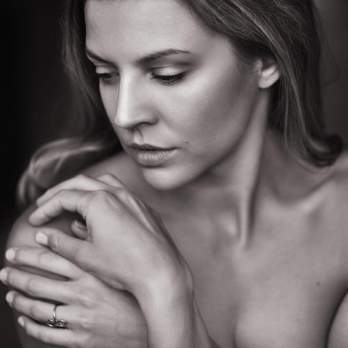 Radiesse vs Sculptra: Which Biostimulator Is Right for You?